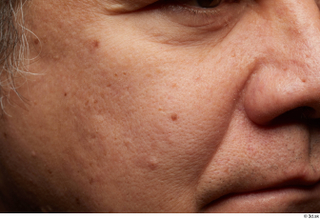 HD Face Skin Alfredo Zorita cheek face nose skin texture…